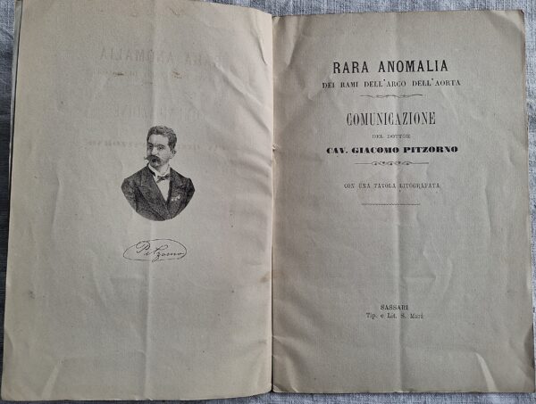 Rara anomalia dei rami dell’arco dell’aorta... del Dottor Cav. Giacomo Pitzorno  Sassari, Tipografia e Litografia S. Mari, s.d. [fine XIX secolo] - immagine 3